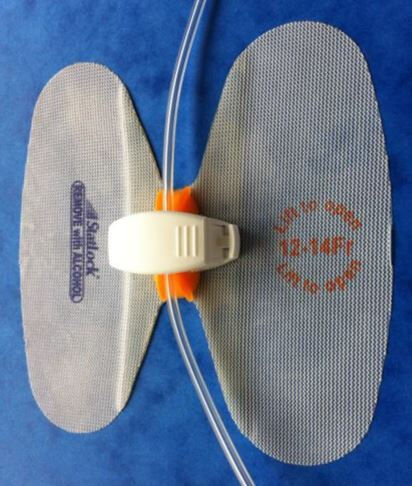 Statlock Fixatiepleister Universal Plus per 25ST