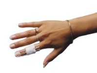 Bandafix elastisch netverband kant en klaar helanca nr. 10 vinger per 10st. - afbeelding 0