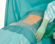 Barrier incisiefolie