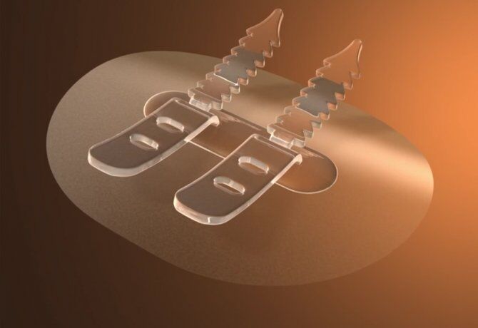 Bioderm katheterfixatieplak per stuk