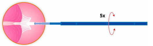 Cervix brush verpakt per 50st. - afbeelding 1