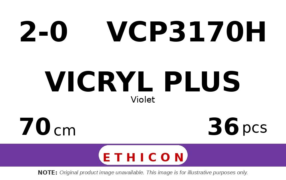 Vicryl Plus VCP3170H hechtdraad - JB 2-0 - 70cm - | per 36 st. |