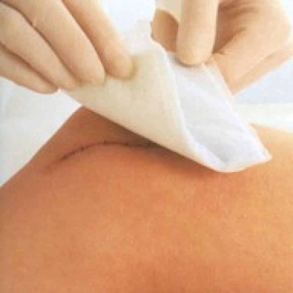 Absorberende kompressen voor licht exsuderende wonden