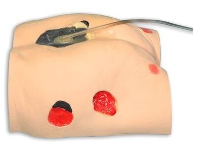 Decubitusverzorgings model - afbeelding 0