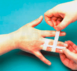 medisch durapor tape voor immobiliseren van vingerspalken