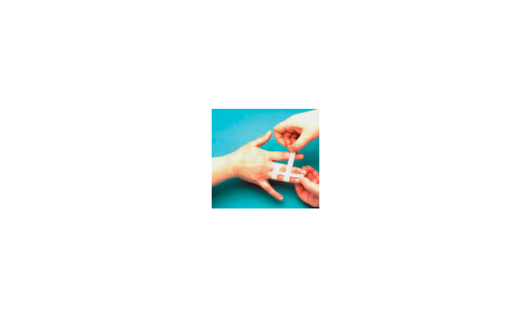 medisch durapor tape voor immobiliseren van vingerspalken