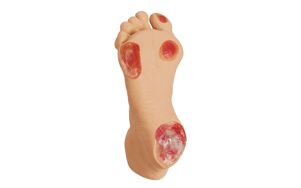 Oudere decubitus voet