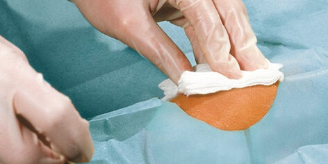 Steriel laken met gat gatlaken