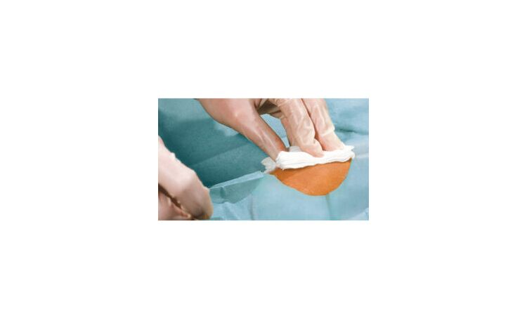 Operatiedoek met gat zeflklevend variabel Foliodrape protect