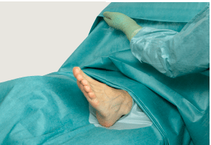 hand- en voetlaken barrier