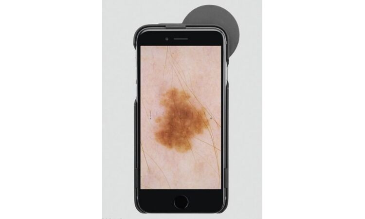 Heine dermatoscoop ic1 set iphone 5/5s/se
