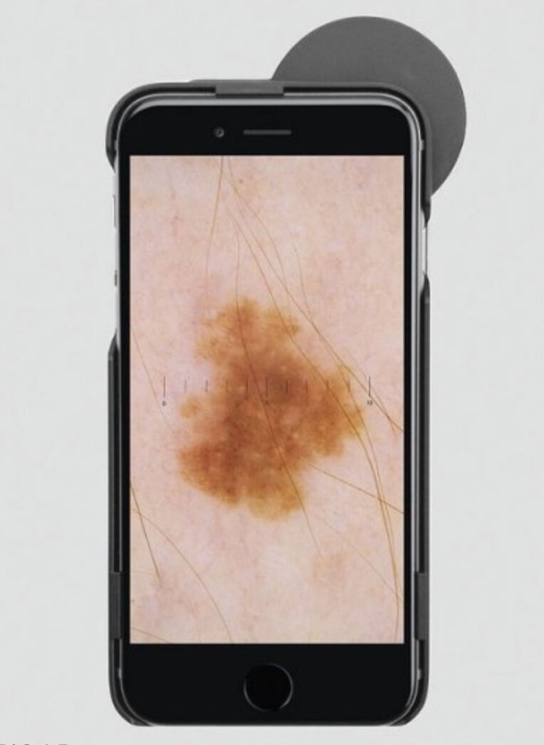Heine dermatoscoop ic1 set iphone6/6s