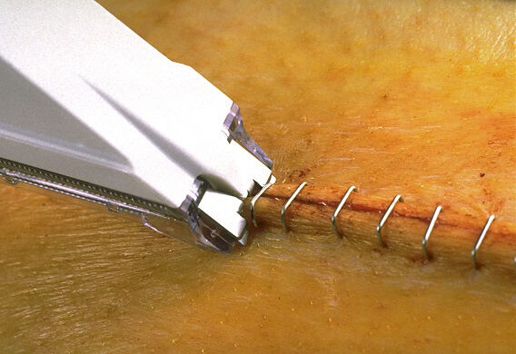 disposable skin stapler 3m vista precise