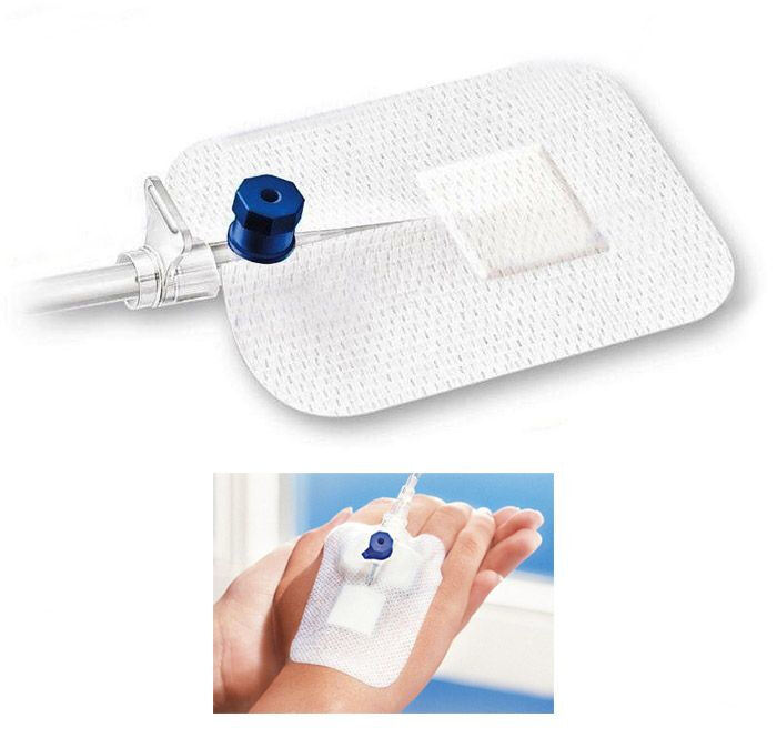 cosmopor infuuspleister fixeert het infuus systeem