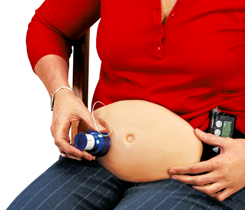 Injectie buik voor insuline prikken