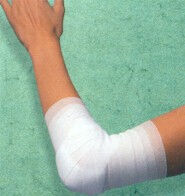 Klinifix elastische zwachtel