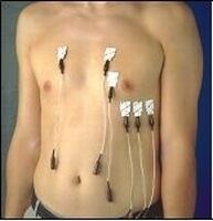 Krokodillenbekstekker voor aansluiting 3/4mm per stuk