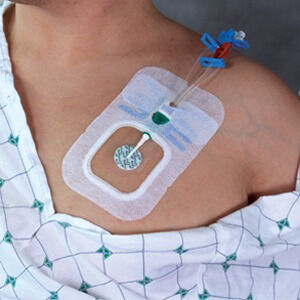 BIOPATCH 2,5CM-4MM DS40