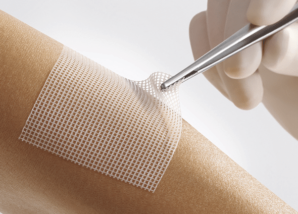 lomatuell pro verband wisselen