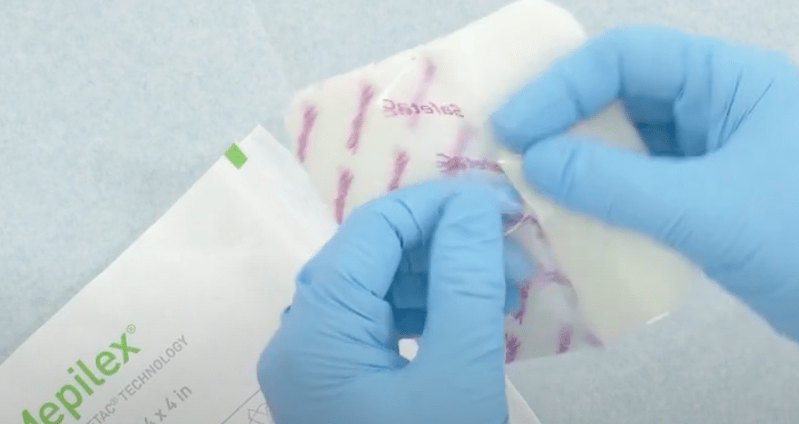 mepilex safetac verband