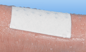 Noba Rudafilm transparante waterbestendige eilandpleister 10x8cm per 50st - afbeelding 3