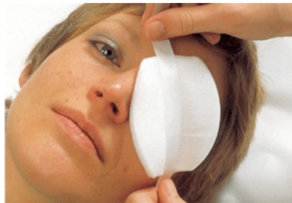 Eycopad Oogkompres 56x70mm Ovaal Steriel 25 stuks