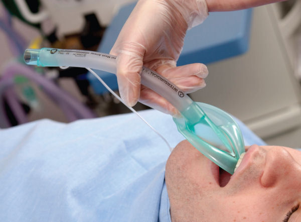 larynxmaskers voor intubatie op de spoedeisende hulp of anesthesie