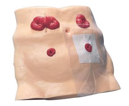 Stoma oefenmodel buikplaat incl. koffer