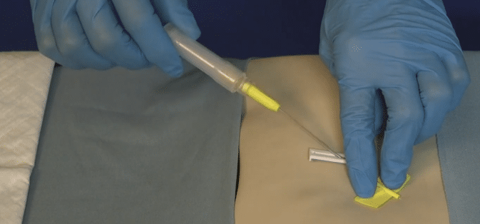 BD Saf-T-Intima vleugelnaald zonder bijspuitpunt per 25ST  - afbeelding 3