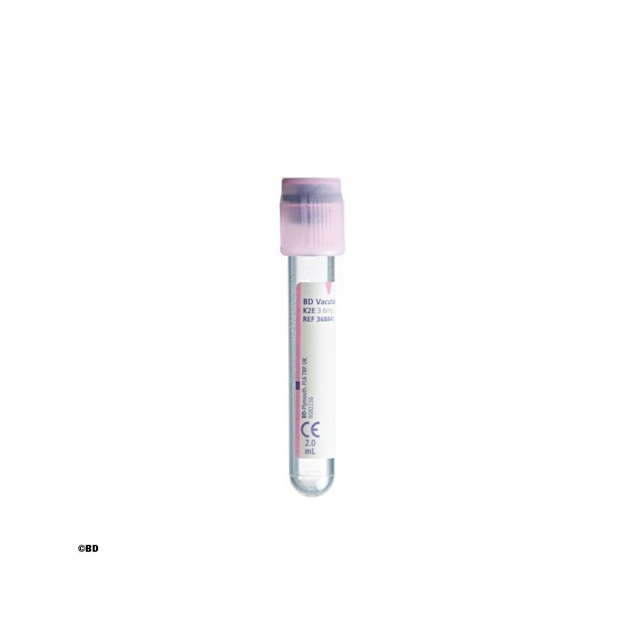 Vacutainer K2 EDTA buisjes roze 2ml