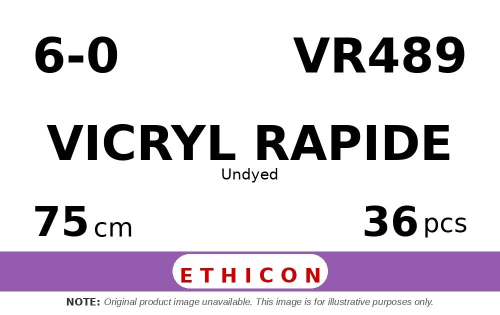 Vicryl Rapide VR489 hechtdraad - P-1 6-0 - 75cm - | per 36 st. |