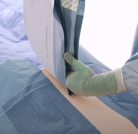 Steriel afdekken abdominale chirurgie