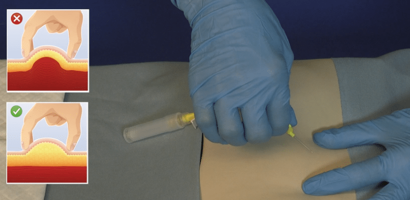 BD Saf-T-Intima vleugelnaald zonder bijspuitpunt per 25ST  - afbeelding 4