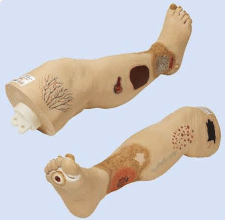 Oefenbeen met veneuze insufficiëntie